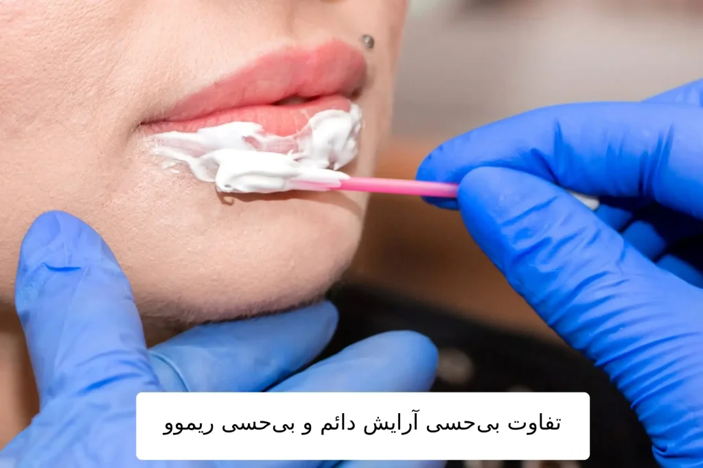 تفاوت بی_حسی آرایش دائم و بی_حسی ریموو