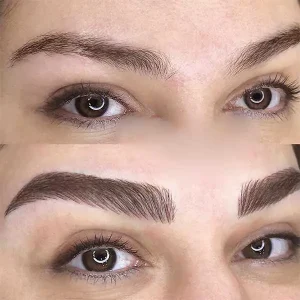 عکس فیبروز ابرو